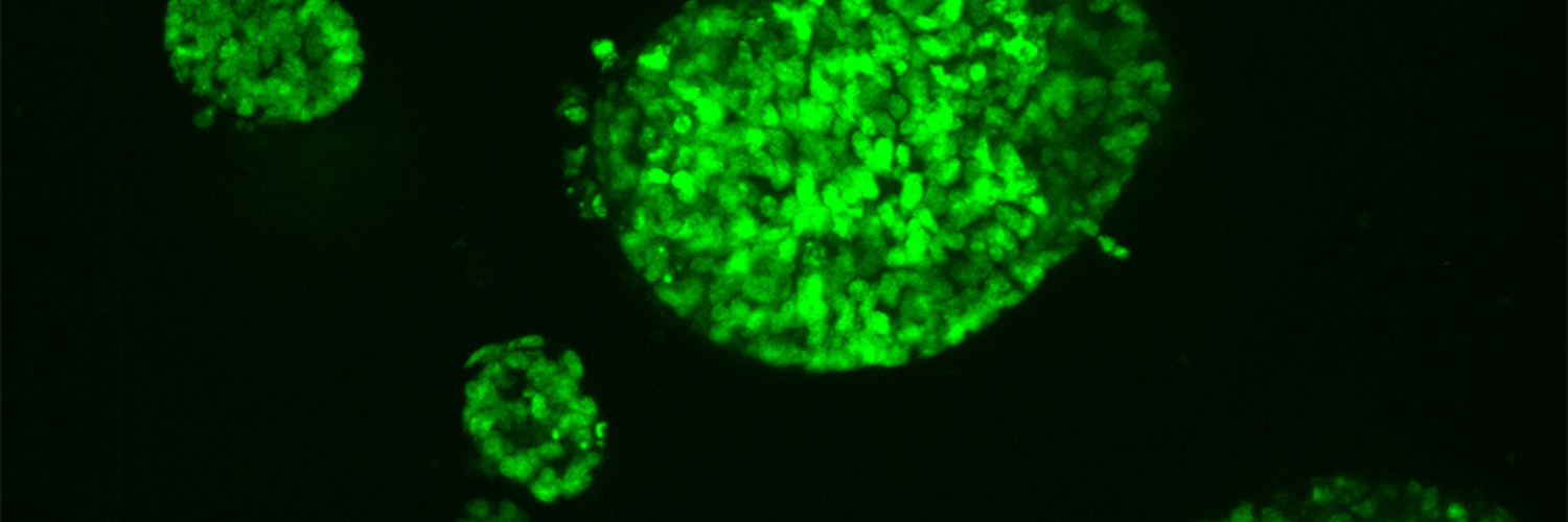 Bowel Cancer Awareness Talk